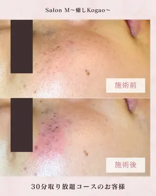 シミケア Salon Mのエステ・リラクイメージ