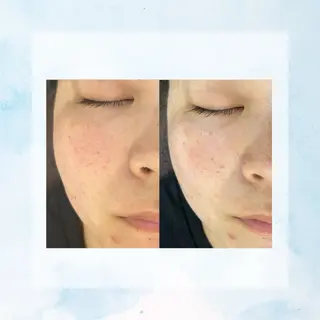 Belle beauty salon所属・Bellebeau tysalonのエステ・リラクイメージ