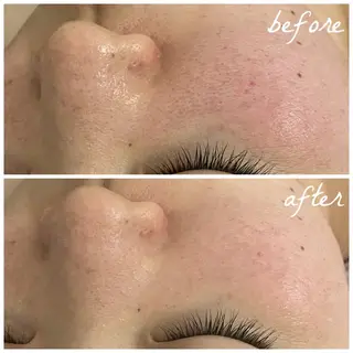 メンズ メナード岐阜茜部 杉浦のエステ・リラクイメージ