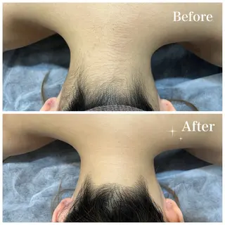 脱毛サロン fam.豊澤柚良のエステ・リラクイメージ