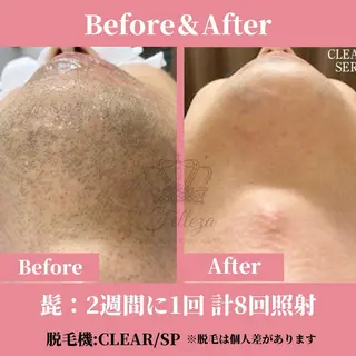 メンズ 有人型セルフサロン 脱毛/痩身/美顔のその他イメージ