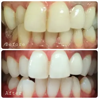 ほわいと あざぶのマツエク・マツパデザイン