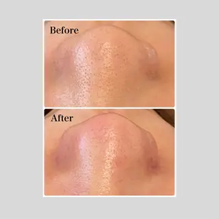 マツエク・マツパ 韓国肌管理 【毛穴専科】のエステ・リラクイメージ