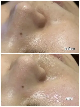 ENCHANT 脱毛.小顔.毛穴のエステ・リラクイメージ