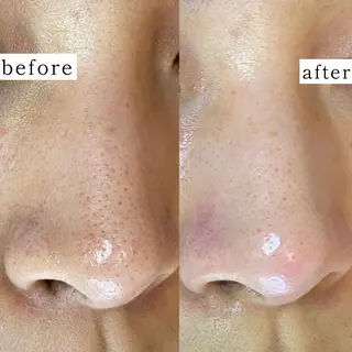 毛穴専門サロン　フルール所属・フルールFululu 自由が丘のエステ・リラクイメージ