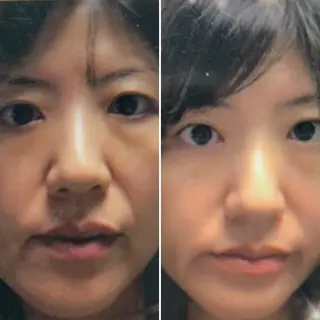 痛くないシミ取り 【荻窪】石橋のヘアスタイル