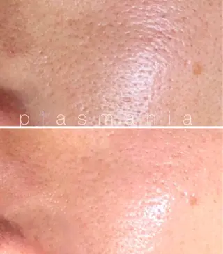 private salon éclat所属・ニキビ・毛穴専門 éclat/エクラのエステ・リラクイメージ