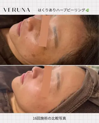 Les Prages(プラージュ)所属・サロン プラージュのエステ・リラクイメージ