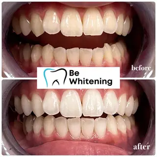 ホワイトニングサロン BE WHITE金山のその他イメージ