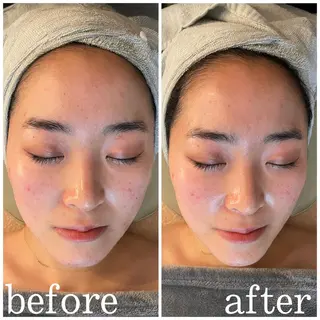 うなじ脱毛/美肌脱毛 LABELのエステ・リラクイメージ