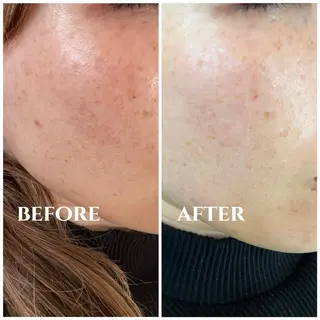 Dimples所属・Dimples ERINAのエステ・リラクイメージ