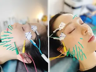 小顔美容鍼専門サロン 渋谷YZのその他イメージ