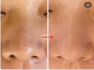 ニキビ・毛穴に特化◎ CREVIA.のエステ・リラクイメージ