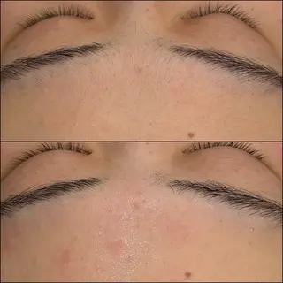 LiZA エステティックサロンのエステ・リラクイメージ