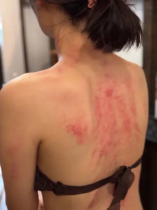 かっさ（刮痧）専門店 心氣院のその他イメージ