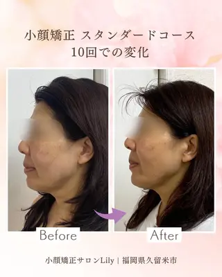 小顔矯正サロンLily所属・小顔矯正サロン Lilyのエステ・リラクイメージ