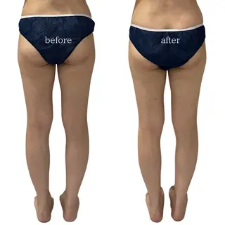 オフ:オン所属・オフ:オン 全身筋膜マッサージのエステ・リラクイメージ