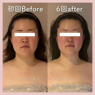 小顔矯正専門店Gémiey所属・越谷駅徒歩３分 小顔専門Gemieyのエステ・リラクイメージ