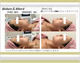 nico sideのエステ・リラクイメージ