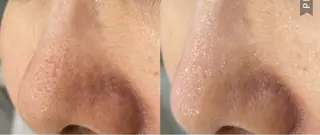 DeI'm   名古屋栄所属・小林 玲菜のエステ・リラクイメージ