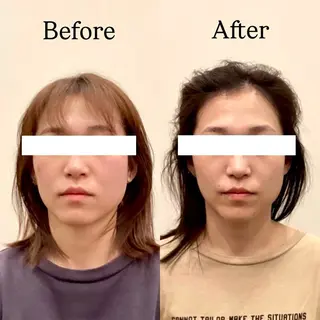 Hari Lounge恵比寿所属・chika🦋 ハリラウンジ恵比寿のエステ・リラクイメージ