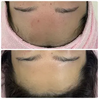 Salon Rion所属・Rion 野々村のエステ・リラクイメージ