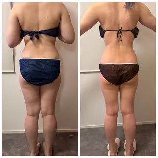 本気で痩せたい方へ 痩身専門サロンのエステ・リラクイメージ