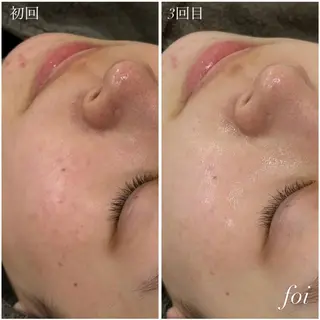 艶肌デトックス🫧 Samiraのエステ・リラクイメージ