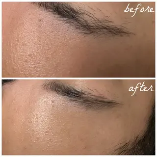 メンズ メナード岐阜市茜部 杉浦のエステ・リラクイメージ