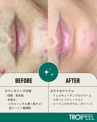 salonCOCO所属・肌管理看護師💎 salonCOCOのエステ・リラクイメージ