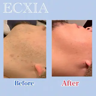 脱毛サロン ECXIA【博多】のエステ・リラクイメージ