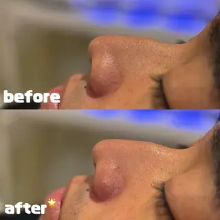 HAREHADA 🫧/ Ibukiのその他イメージ