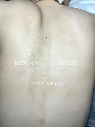 HOTEL&PARK . ワックス脱毛のエステ・リラクイメージ