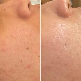 韓国🇰🇷価格 サロン_Nbibiのエステ・リラクイメージ