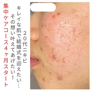 ベラージュ【美背中・ 美尻・フェイシャル】のエステ・リラクイメージ