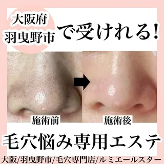 シミケア放題専門 /杉原いくえのエステ・リラクイメージ