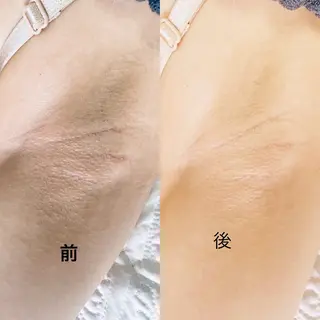 Thu Huyen Beauty所属・トウ フェンのエステ・リラクイメージ