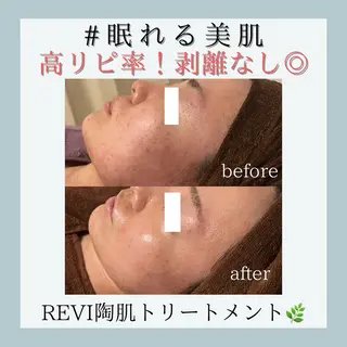 小嶋萌 今池駅徒歩2分のエステ・リラクイメージ