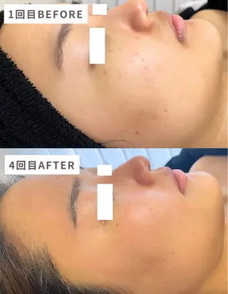 lapeca〜ラペカ〜所属・肌ケアサロン🌿 lapeca 土井のエステ・リラクイメージ