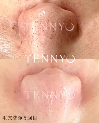 【クリニック提携】salon de moffyサロンドモフィ所属・【クリニック提携】 サロンドモフィ吉岡のエステ・リラクイメージ