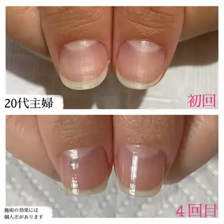 ネイル 自爪育成専門サロン エムロードゥ池下のネイルデザイン