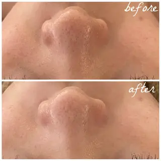 メンズ メナード岐阜市茜部 杉浦のエステ・リラクイメージ