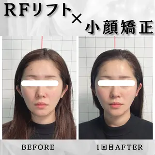 小顔矯正専門店 【RED】池田のエステ・リラクイメージ