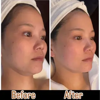 ビューティーサロン　プリズム所属・久留本 茜のエステ・リラクイメージ