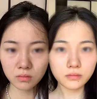 マツエク・マツパ 愛維美水光美肌専門店所属・愛維美水光美肌専門店 メンズレディースokのエステ・リラクイメージ