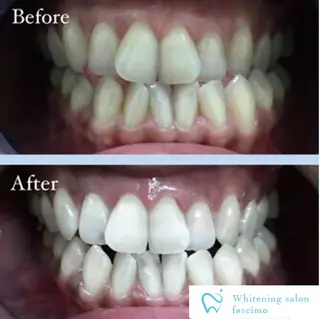 セルフホワイトニングサロンfascimo所属・ホワイトニングサロン fascimo新座店のその他イメージ