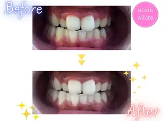 エクシアホワイトニング草津店所属・nanami -ホワイトニングのその他イメージ