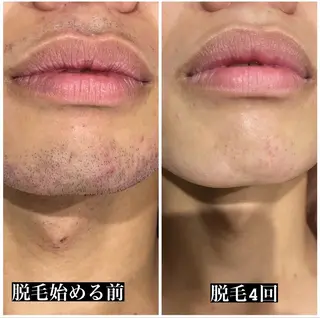 メンズ脱毛&メンズ眉毛サロン  kyle.横浜所属・メンズ眉/HBL/ sakiの眉毛・アイブロウイメージ