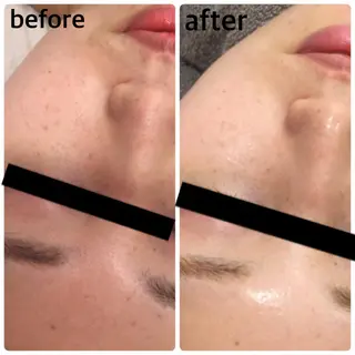 美肌脱毛・ハーブピーリング専門店Larin la beaute所属・Larin la beauteのエステ・リラクイメージ