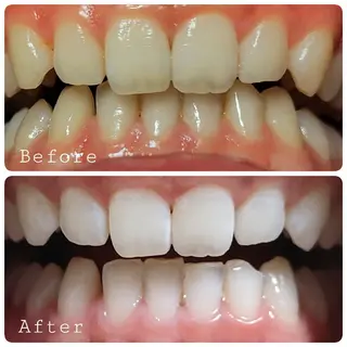 ほわいと あざぶのマツエク・マツパデザイン